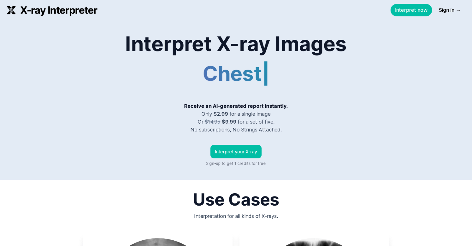 X-ray Interpreter